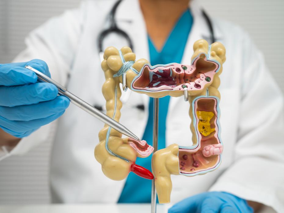 iStock/sasirin pamai